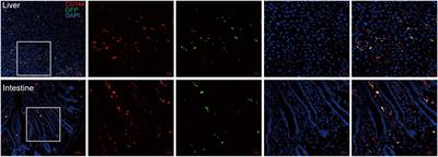 EPC infusion ameliorates acute graft-versus-host disease-related endothelial injury after allogeneic bone marrow transplantation